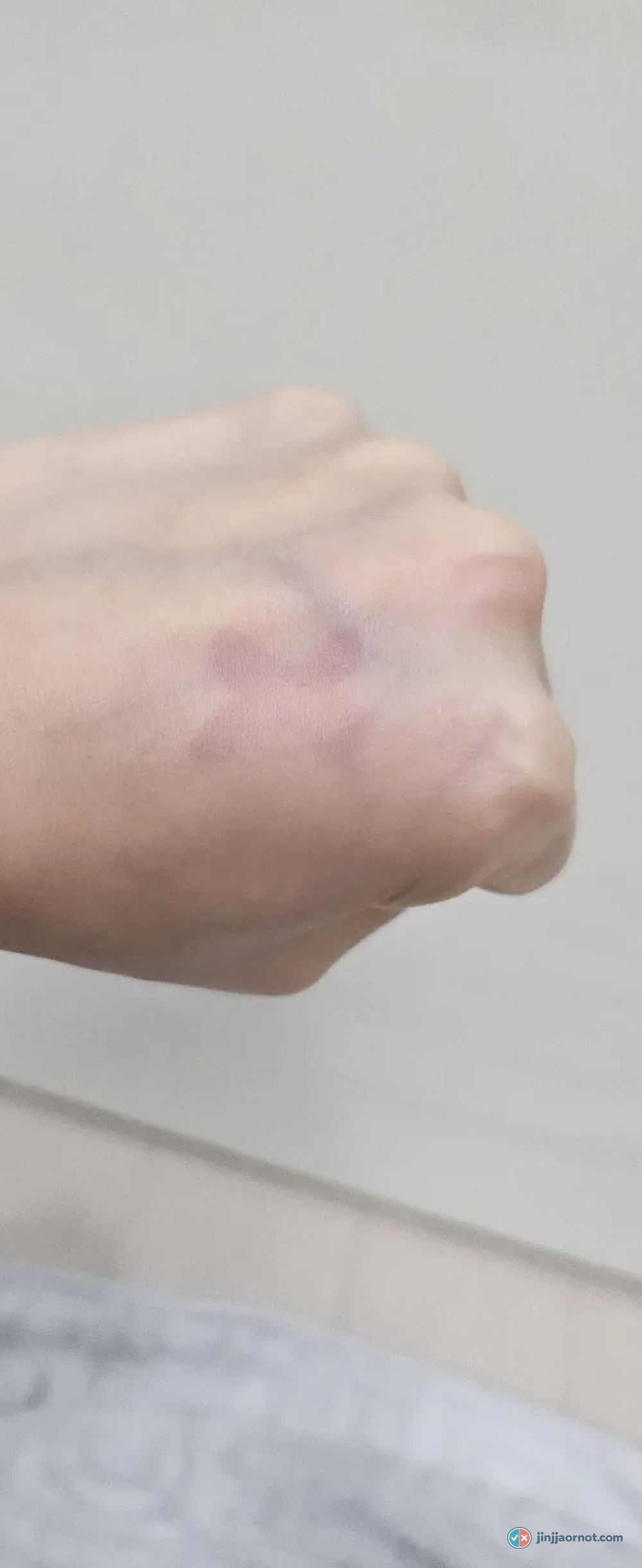 Back of a hand after rinsing with the Round Lab 1025 cleanser, showing clear pink patches